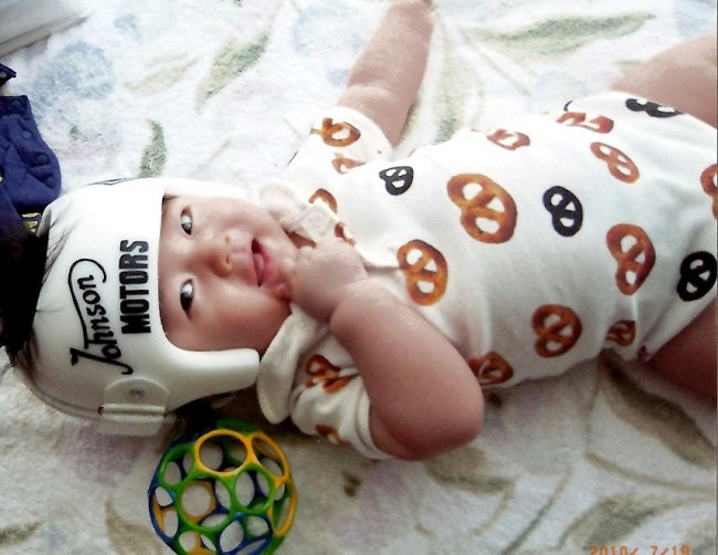 大渕弁護士がブログに綴った 頭蓋形状誘導ヘルメット で治療した体験記 シティリビングweb